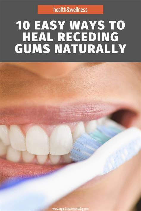 10 Easy Ways To Heal Receding Gums Naturally Healthy Lifestyle Reverasite