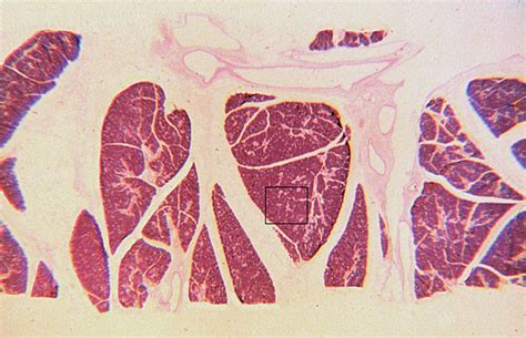 Hls Epithelial Tissue Surface Specializations And