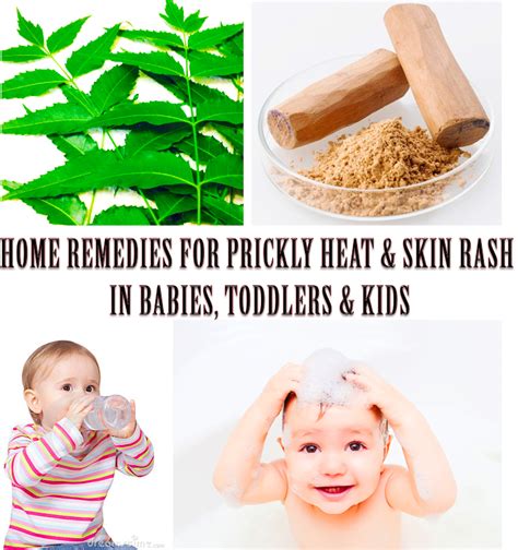 Home Remedies For Prickly Heat Rash On Babies Heat Rash Treatment For