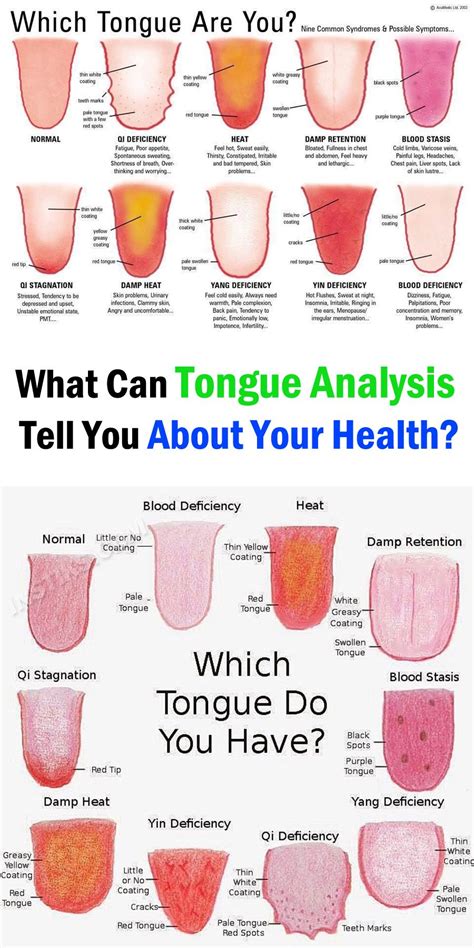 What Does Your Tongue Say About Your Health Health Tips Health