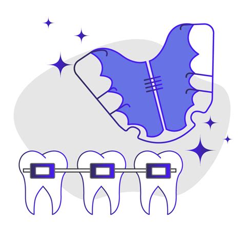Teeth have the possibility of changing position throughout life. Do You Really Need a Retainer After Braces? | Smile Prep