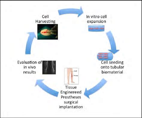 The Traditional Vascular Tissue Engineering Approach Tebv Total