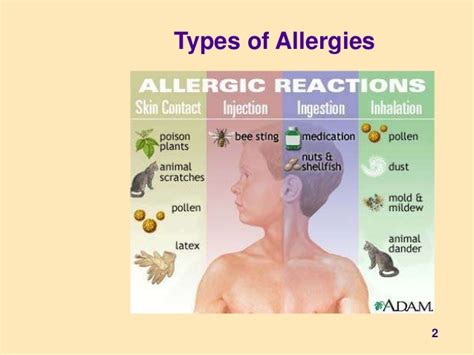Iv type of allergic reaction part i. Allergies, Allergens and Food Handlers by SSFPA