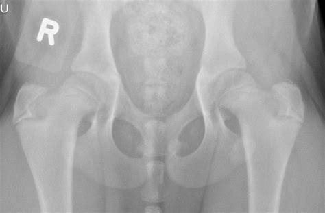 Billings Dog And Hip Xrays Pennhip Radiographs