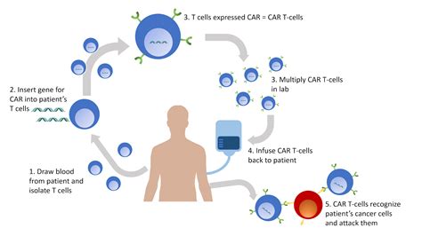 Car T Cell Therapy Nc Dna Day Blog