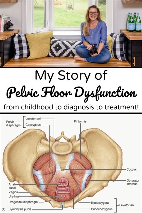My Story Of Pelvic Floor Dysfunction From Childhood To Pelvic Floor Pt