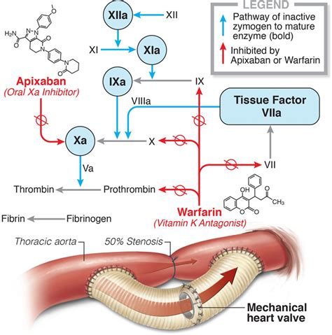 Apixaban Versus Warfarin For Mechanical Heart Valve Thromboprophylaxis