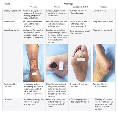 Evaluation And Management Of Lower Extremity Ulcers Nejm Resident 360