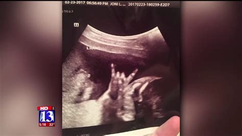 Utah Couples Unique Ultrasound Shows Baby Destined To Rock ‘n Roll