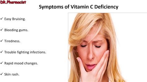 Symptoms Of Vitamin C Deficiency YouTube