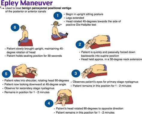 Epley Maneuver Nursing School Survival Nurse Practitioner School Nursing Procedures