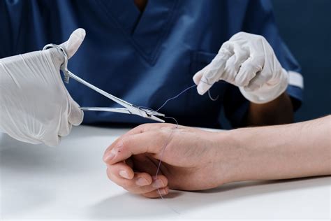 How To Know If A Cut Needs Stitches Urgent Care University Urgent Care