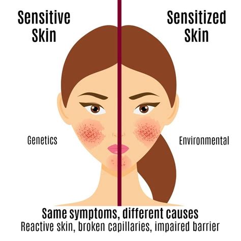 Sensitive Or Sensitized Skin Charmed Medispa