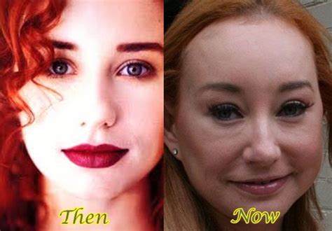 Tori Amos Plastic Surgery Before And After Latest Plastic Surgery