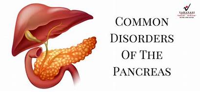 Pancreas Disorders Common Know Vh Admin Health