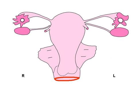 Histopathology Of The Uterine Cervix Digital Atlas