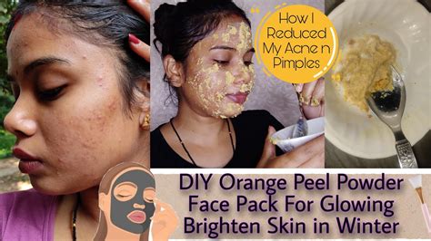 How I Reduced My Acne N Pimplesdiy Orange Peel Powder Face Pack For