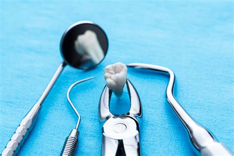 Post Tooth Extraction Care Tips