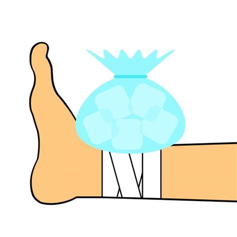 Icing Injury Illustrations Royalty Free Vector Graphics And Clip Art