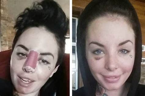 Alleged War Machine Victim Christy Mack Posts Before And After Photos Releases Another