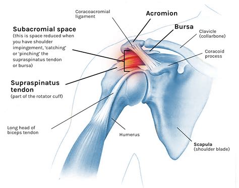 Shoulder Ligament Anatomy Diagram Shoulder Impingemen Vrogue Co