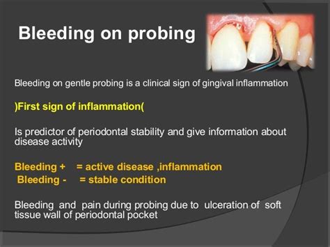 Periodontal Examination And Diagnosis