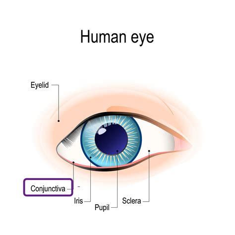 Conjunctiva Eye Patient