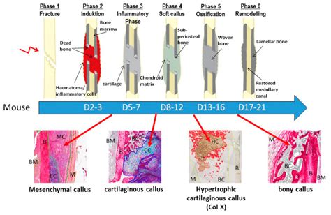 If the overlying soft tissues are also injured, fracture healing may be delayed or disrupted, particularly in anatomic regions with decreased vascular networks such as the. A representative figure showing the different murine ...