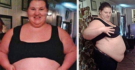 Woman Who Gorged On 11000 A Day Sheds 17st You Wont Believe What