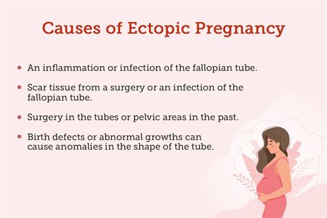 Ectopic Pregnancy In Ivf Causes Diagnosis Treatment