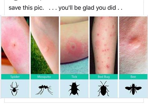 How To Identify Insect Bites🐜🦗 Follow Us For More Hacks