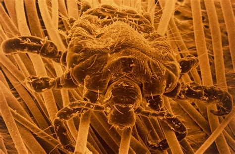 A Close Up View Of An Insects Head And Legs In Sepia Tone