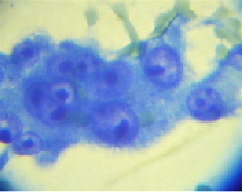 Microscopic Image In Diff Quick Stain Objective 100x10 Figure 4