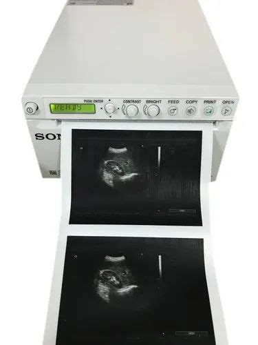 Sony Thermal Ultrasound Printer At Rs 50000piece Ultrasound Printer