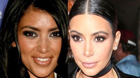 Kim Kardashian Before And After Plastic Surgery Heat Hair And Beauty