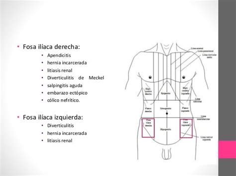 Dolor Abdominal