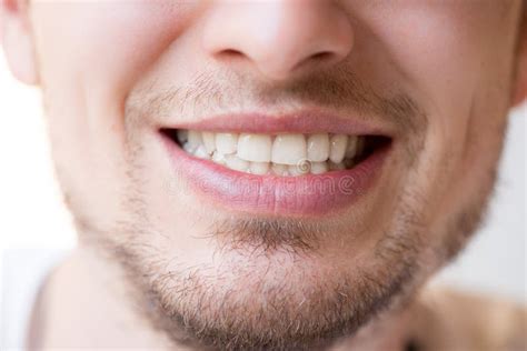 Young Man Smiles In The Camera White Teeth Lips And Beard Stock Photo