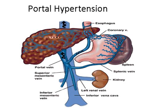 Dr Abhishekh Portal Hypertension Specialist In Gurgaon