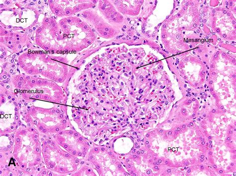 Kidney Renal Corpuscle Glomerulus American Urological
