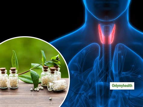 Homeopathic Approach For The Treatment Of Hypothyroidism Onlymyhealth
