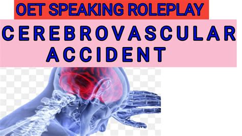 OET SPEAKING ROLEPLAY Nursing Cerebrovascular Accident YouTube