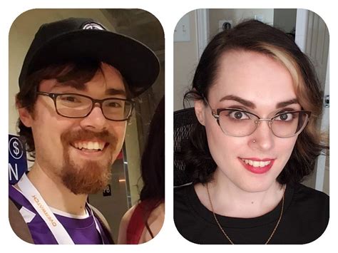 Roughly 2 Years Between These Pictures Left 15 Years Hrt Right 8