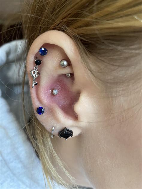Does My Conch Piercing Look Infected Should I See A Doctor Rpiercing