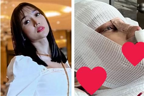 foto dan video operasi lucinta luna mendadak menghilang di feed di instagramnya kesatu