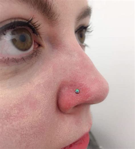 Nostril Piercing Infection
