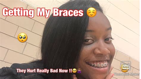 Getting My Braces Vlog Youtube