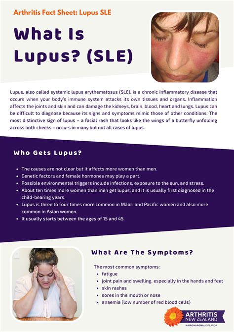 Lupus Arthritis New Zealand