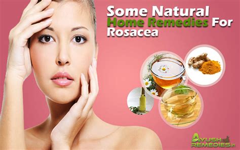 7 Home Remedies For Rosacea Say Goodbye To Your Skin Woes