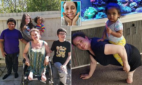 Mum Of Four Who Needed Both Legs Amputating After A House Fire Claims Accident Made Her Life