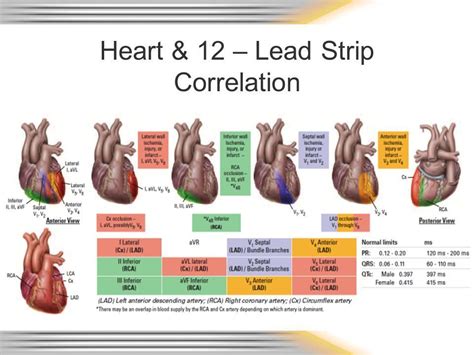 Ecg Coronary Artery Anatomy Arteries Anatomy Medical Knowledge